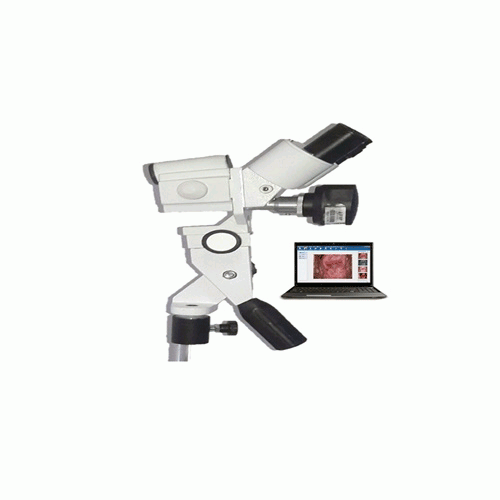 VIDEO COLPOSCOPIO DIGITAL EKHOSON D3